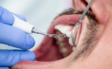 Dental Services Featured Image